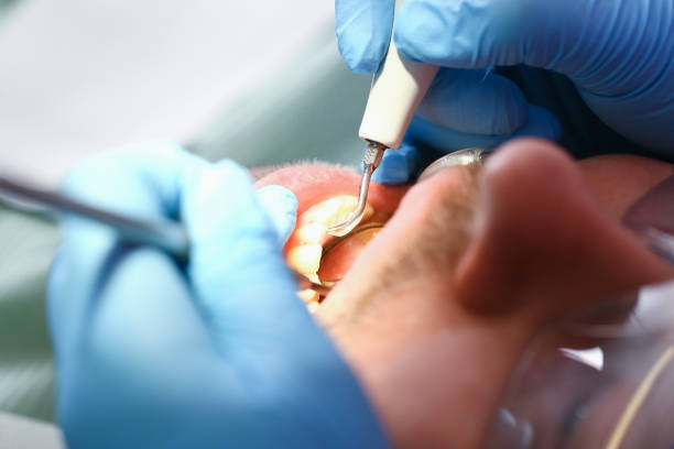 Best Emergency Root Canal Therapy in Central Park, WA