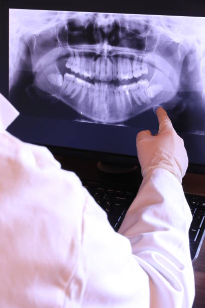 Best Emergency Wisdom Tooth Extraction in Central Park, WA